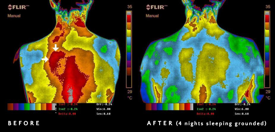 inflammation healing frequency, image of before and after results